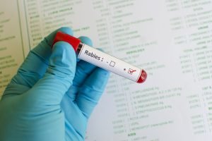 Blood sample with rabies virus positive